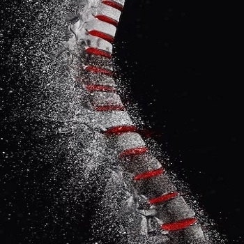 signs of osteoporosis