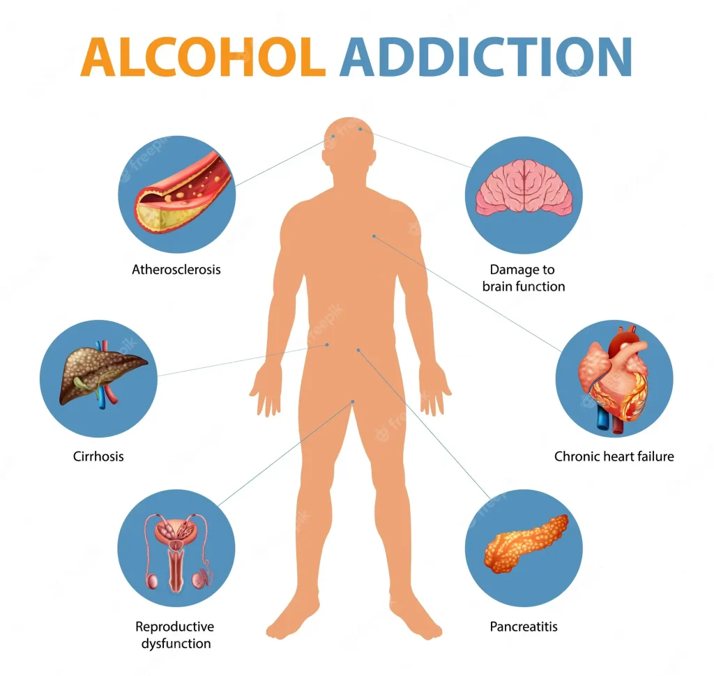 Alcohol Addiction Herbal Solution: Surari Churna