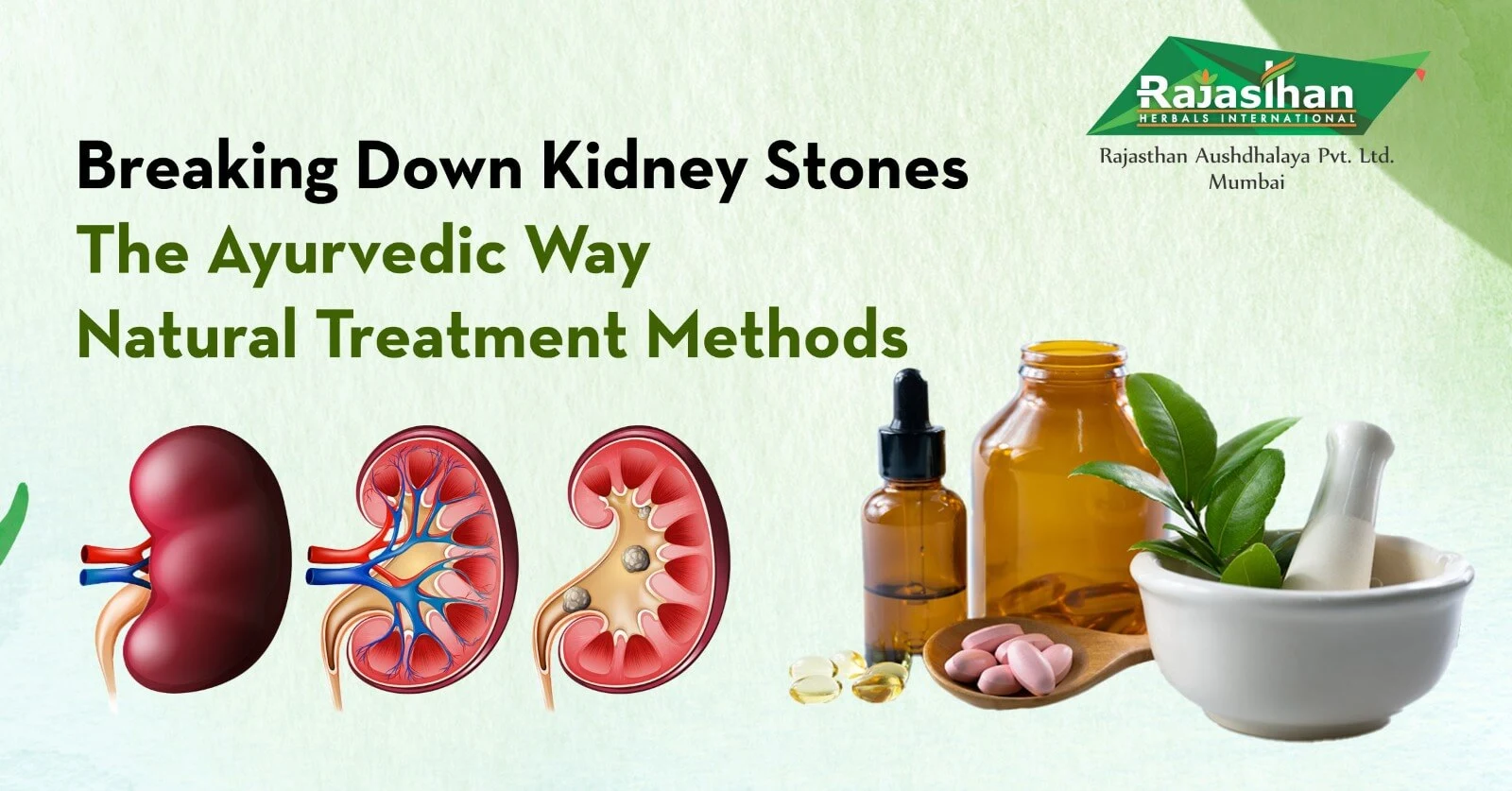 Breaking Down Kidney Stones the Ayurvedic Way: Naturally